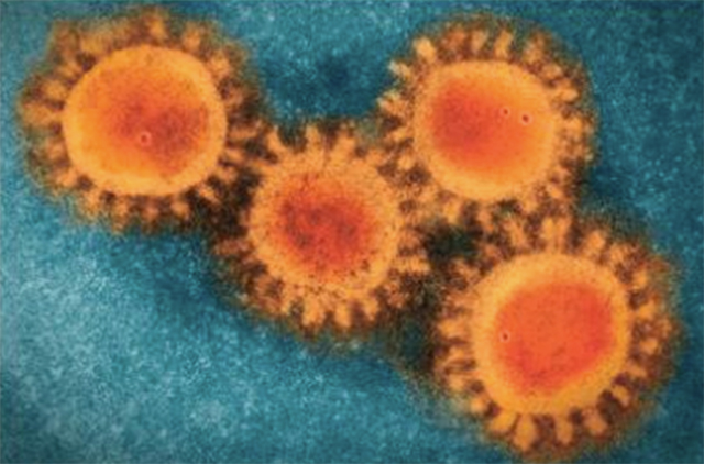 Sant Pau publica un estudi sobre la patogènesi de la COVID-19