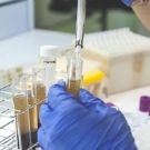 Investigadors de Sant Pau demostren l’eficàcia d’un biomarcador en plasma per detectar Alzheimer en persones amb síndrome de Down
