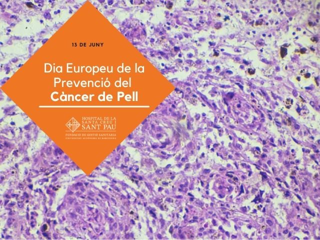 Dia Europeu de la Prevenció del Càncer de Pell