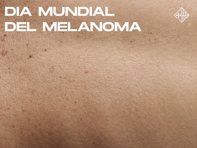 Dia mundial del melanoma