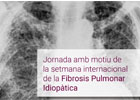 Jornada amb motiu de la setmana internacional de la Fibrosis Pulmonar Idiopàtica