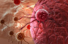 Xerrades de sensibilització entorn el càncer: El càncer s'hereta?