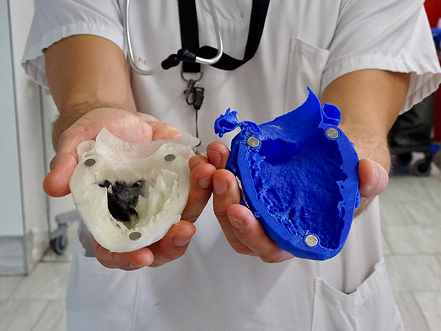 Sant Pau implementa una plataforma d'impressió 3D per al tractament de malalties cardiovasculars