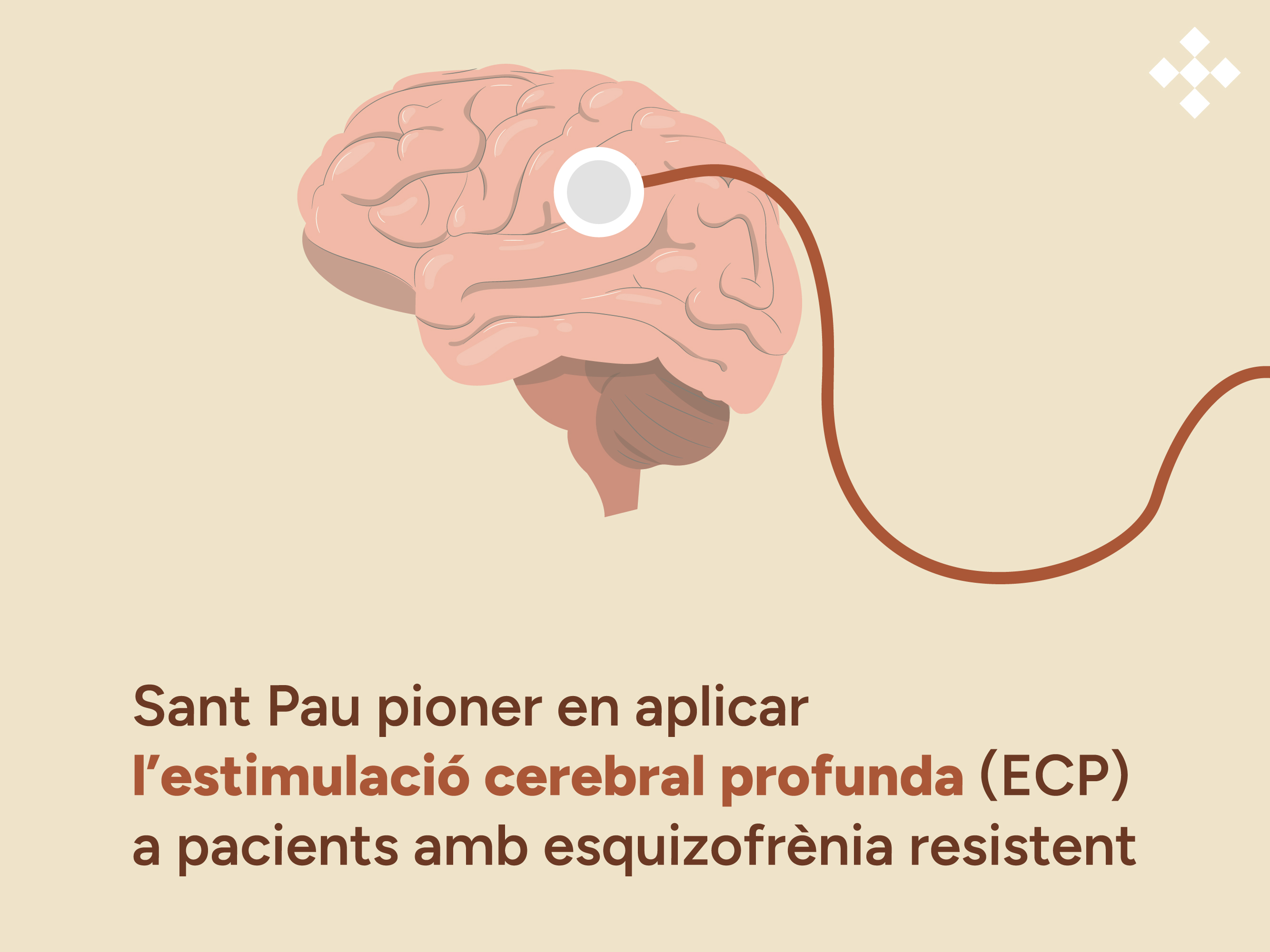 Sant Pau pioner en Estimulació Cerebral Profunda en Esquizofrènia resistent